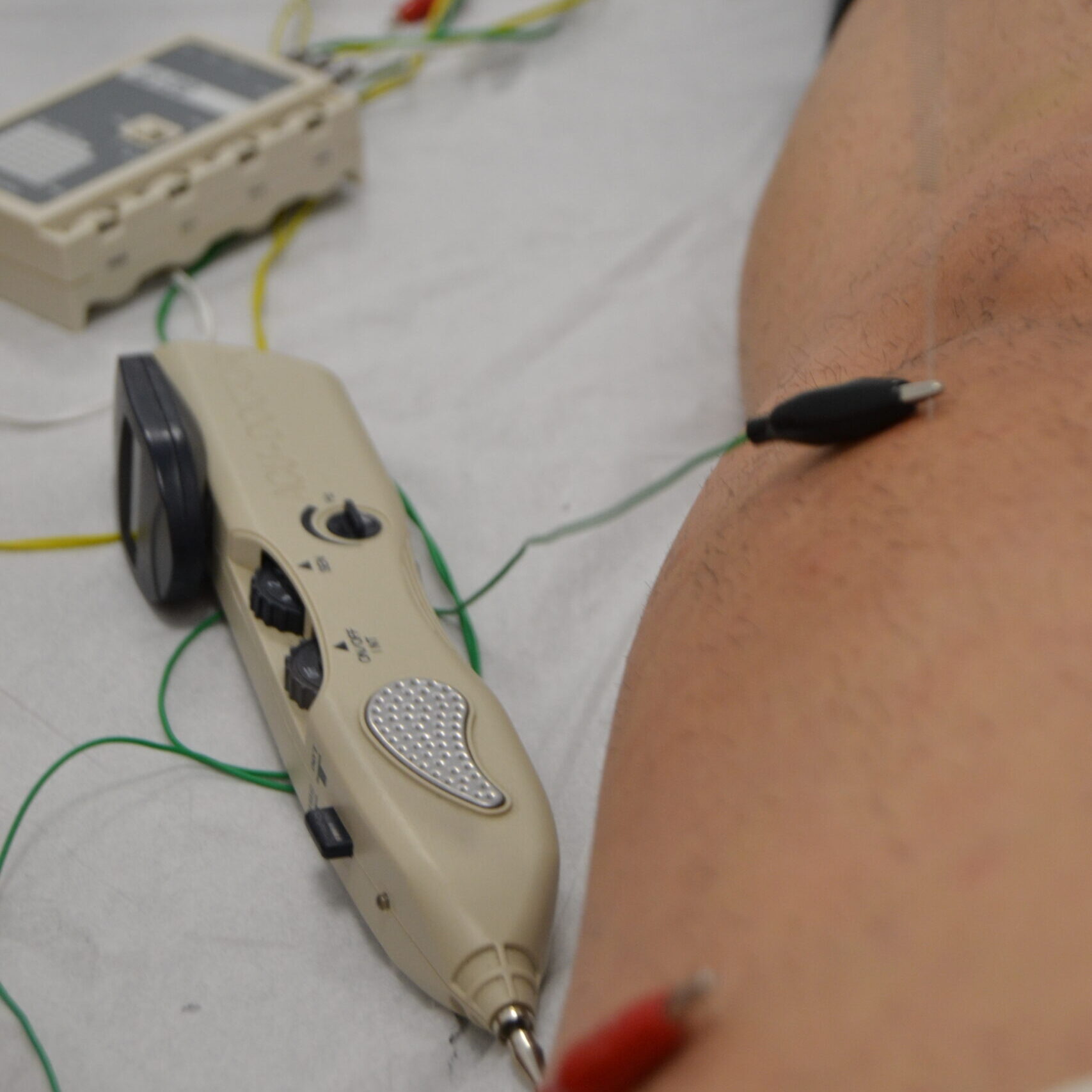 fisioterapia invasiva con punción seca